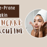 Best Skincare Routine for Acne-Prone Skin